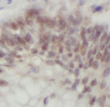 UMPS Rabbit Polyclonal Antibody