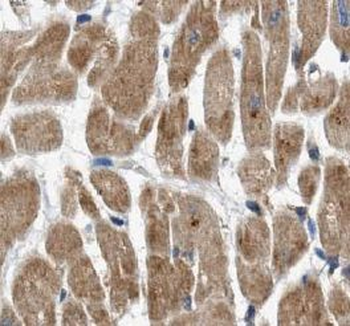 UPB1 Rabbit Polyclonal Antibody