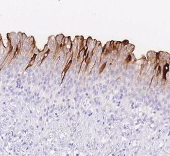 UPK1A Rabbit Polyclonal Antibody