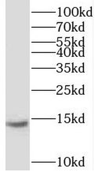 UQCC2 Rabbit Polyclonal Antibody