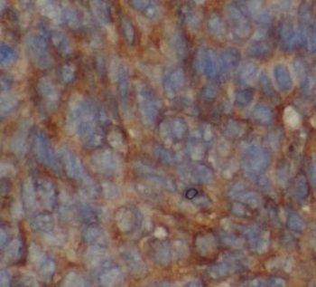 UQCC2 Rabbit Polyclonal Antibody