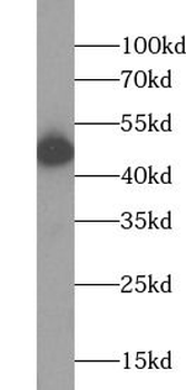 UQCRC1 Rabbit Polyclonal Antibody