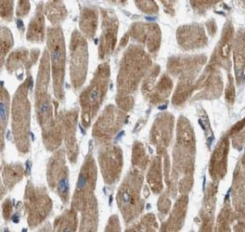 UQCRC1 Rabbit Polyclonal Antibody