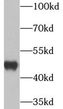 UQCRC2 Rabbit Polyclonal Antibody