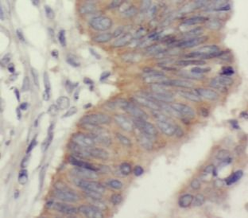 UQCRC2 Rabbit Polyclonal Antibody