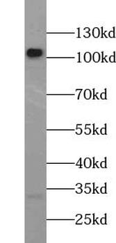 URGCP Rabbit Polyclonal Antibody