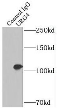 URGCP Rabbit Polyclonal Antibody