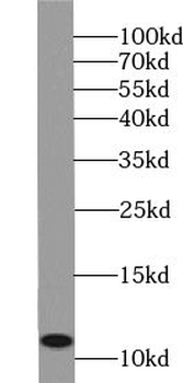 URM1 Rabbit Polyclonal Antibody