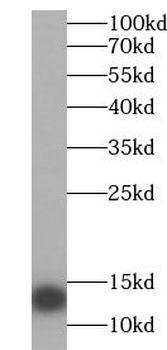 GUCA2B Rabbit Polyclonal Antibody
