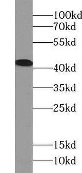 USF1 Rabbit Polyclonal Antibody