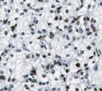 USF1 Rabbit Polyclonal Antibody