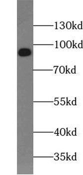 USHBP1 Rabbit Polyclonal Antibody