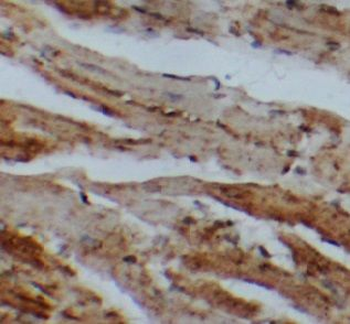 USHBP1 Rabbit Polyclonal Antibody