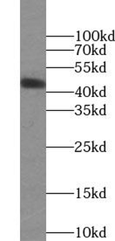 USP12 Rabbit Polyclonal Antibody