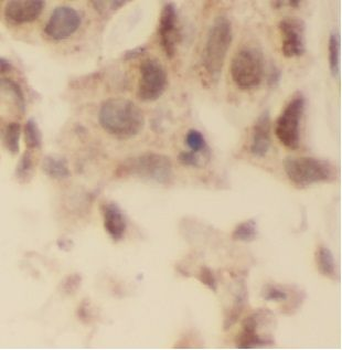 USP28 Rabbit Polyclonal Antibody