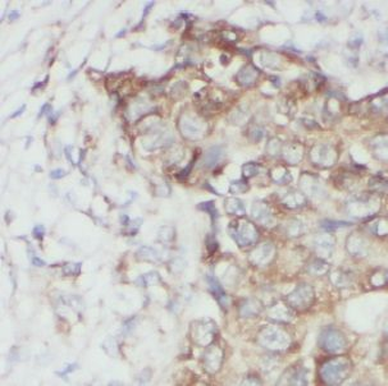 USP34 Rabbit Polyclonal Antibody