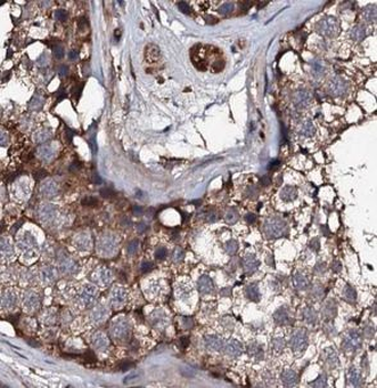 USP50 Rabbit Polyclonal Antibody