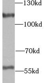 UTP14A Rabbit Polyclonal Antibody