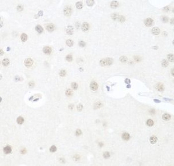 UTP14A Rabbit Polyclonal Antibody
