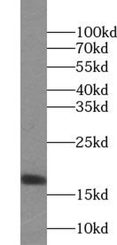UTP23 Rabbit Polyclonal Antibody