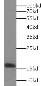 VAMP2 Rabbit Polyclonal Antibody