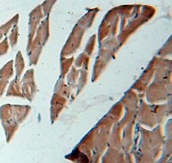 VAMP2 Rabbit Polyclonal Antibody