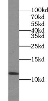 VAMP3 Rabbit Polyclonal Antibody