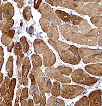 VAMP3 Rabbit Polyclonal Antibody