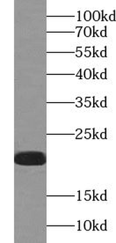 VAMP7 Rabbit Polyclonal Antibody