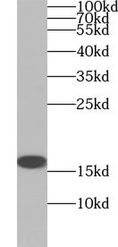 VAMP8 Rabbit Polyclonal Antibody