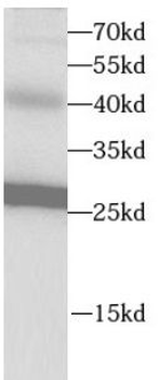 VAPB Rabbit Polyclonal Antibody