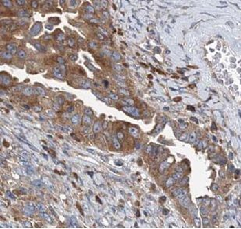 VARS2 Rabbit Polyclonal Antibody