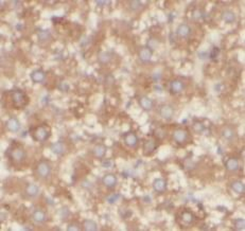 VAV1 Rabbit Polyclonal Antibody