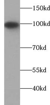 VAV2 Rabbit Polyclonal Antibody
