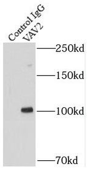 VAV2 Rabbit Polyclonal Antibody