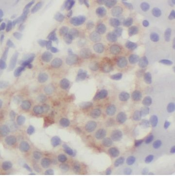 VAV2 Rabbit Polyclonal Antibody