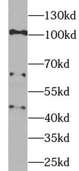 VCAM1 Antibody