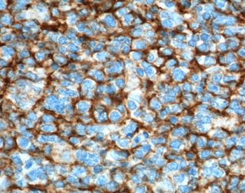 VCAM1 Antibody