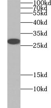 VEGFA Rabbit Polyclonal Antibody