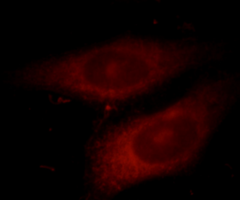 VEGFA Rabbit Polyclonal Antibody