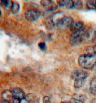 VEGFA Rabbit Polyclonal Antibody