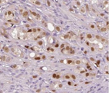 VGLL1 Rabbit Polyclonal Antibody