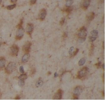 SLC17A7 Rabbit Polyclonal Antibody