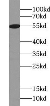 vitamin D binding protein Antibody