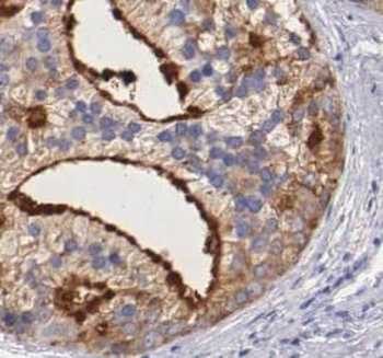 VNN1 Rabbit Polyclonal Antibody