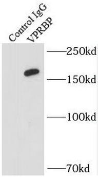 DCAF1 Rabbit Polyclonal Antibody