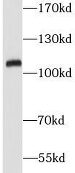 VPS18 Rabbit Polyclonal Antibody