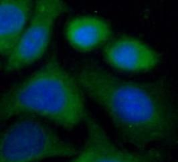 VPS18 Rabbit Polyclonal Antibody