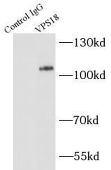 VPS18 Rabbit Polyclonal Antibody
