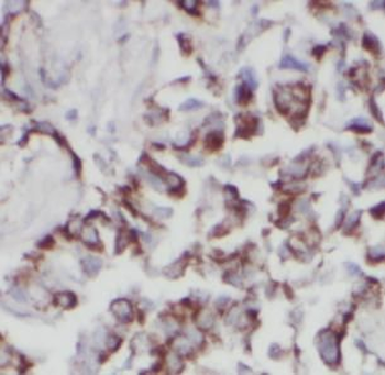 VPS18 Rabbit Polyclonal Antibody